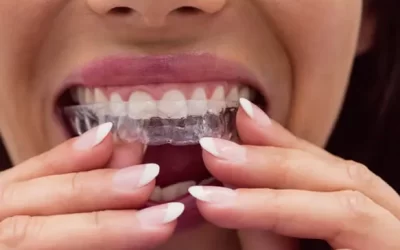 Invisalign Oklahoma City: Clear Aligner Therapy for Discreet Orthodontic Correction